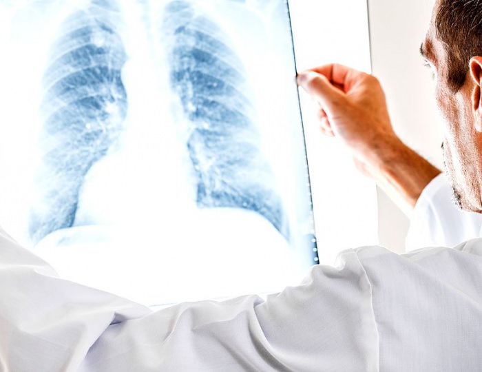 Лечение бронхита - Санаторий «Загорские Дали»