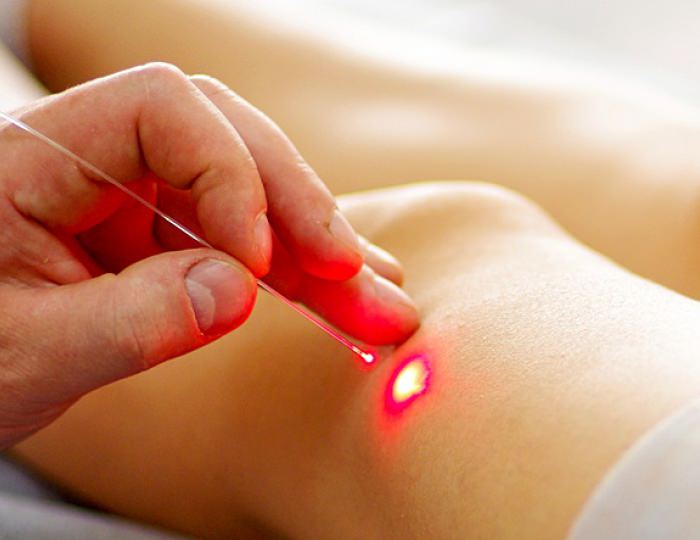 Лазеротерапия - Санаторий «Загорские Дали»